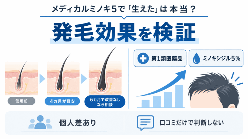 メディカルミノキ5の発毛効果を、ミノキシジル5%と4~6カ月の経過目安で解説した図